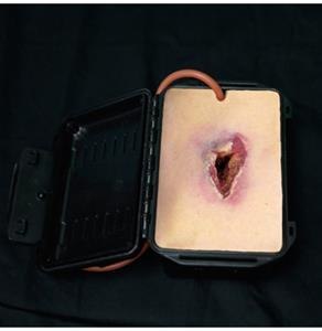 Trenażer Shrapnel Wound in a Box Trenażer Shrapnel Wound in a Box